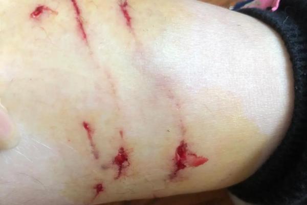 梦到被猫咬 梦到被猫咬