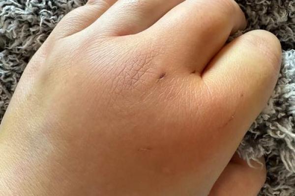 梦见被猫咬了是什么意思 梦见被猫咬了是什么意思