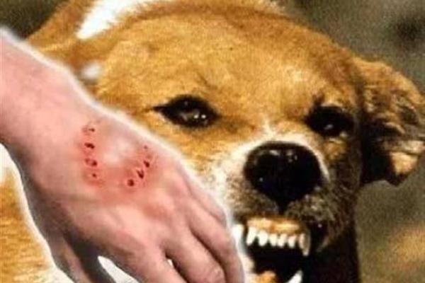 梦见狗咬自己的手 梦见狗咬自己的手