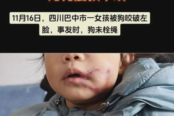 女人做梦狗咬了是什么意思 女人做梦狗咬了是什么意思