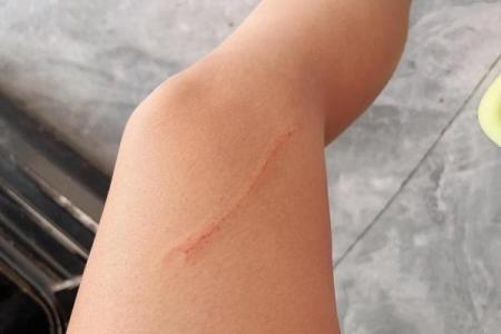 梦见狗抓伤自己的手